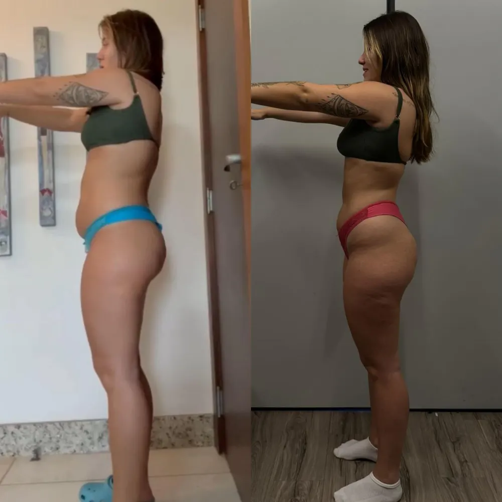Antes e depois de uma paciente da Rafaela ou aluna da Francielli