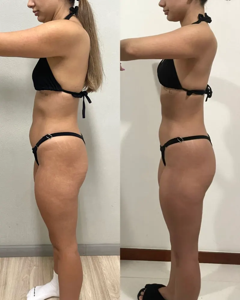 Antes e depois de uma paciente da Rafaela ou aluna da Francielli