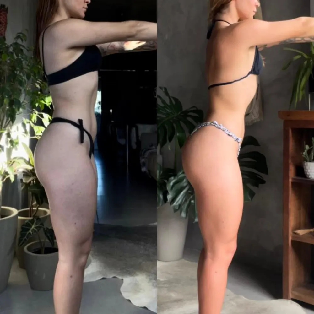 Antes e depois de uma paciente da Rafaela ou aluna da Francielli