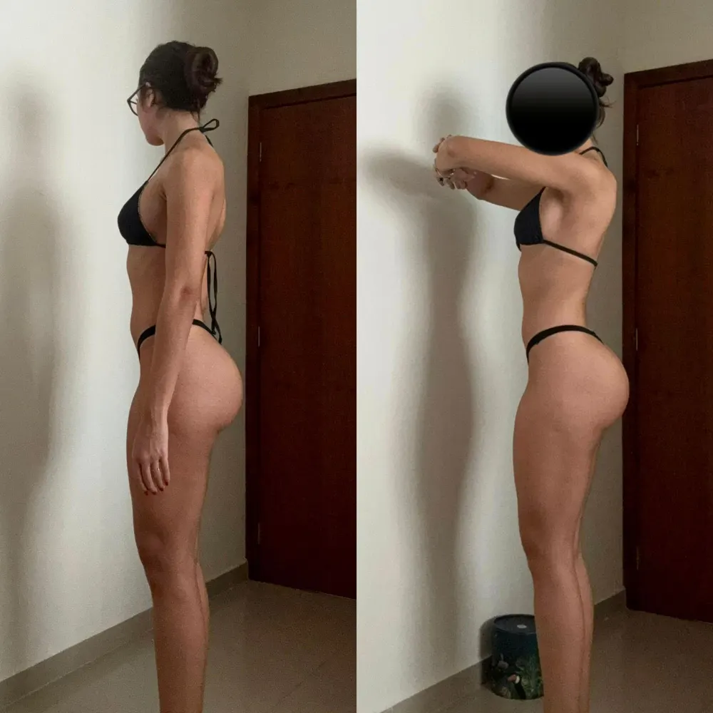 Antes e depois de uma paciente da Rafaela ou aluna da Francielli