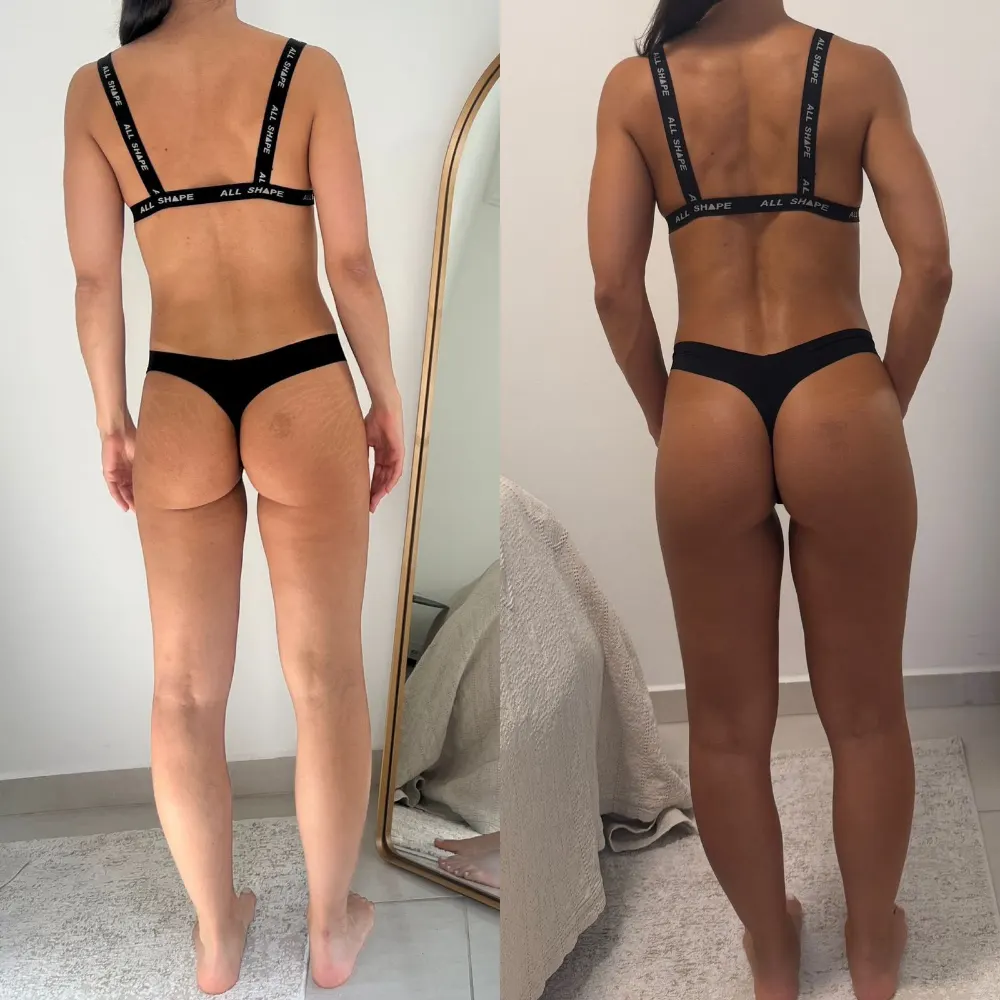Antes e depois de uma paciente da Rafaela ou aluna da Francielli