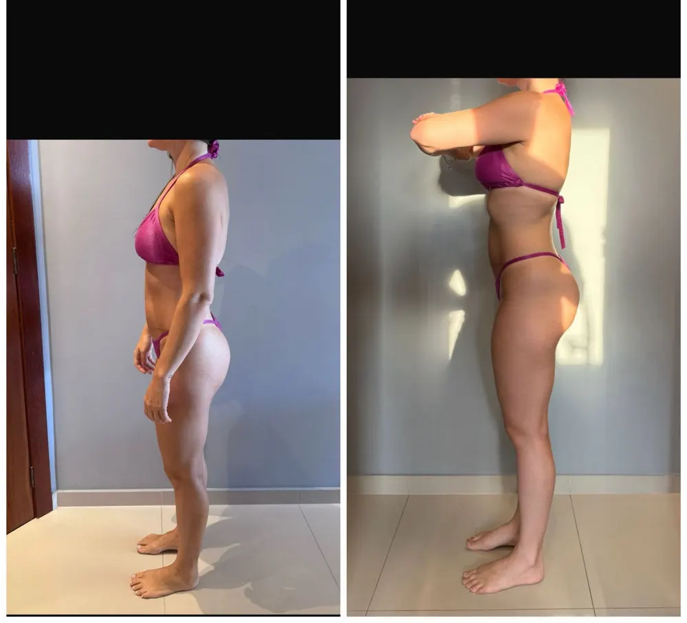 Antes e depois de uma paciente da Rafaela ou aluna da Francielli